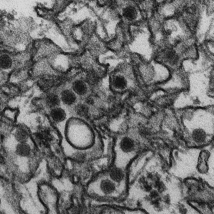 Eletromicrografia do vírus Zika, que é um membro da família Flaviviridae. As partículas virulentas têm um diâmetro de 40nm, com um envelope externo e um centro denso. (CDC)