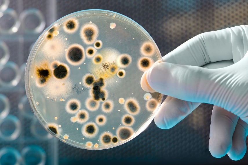 Petri dish with bacteria in a hand of scientist