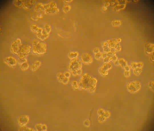 Foto tirada pela equipe de Daniela Grimm Esferoides multicelulares tridimensionais de tumores que começam a se formar depois da exposição á microgravidade real.