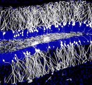 Neurônios recém-gerados (branco) que integrados no hipocampo, mostrados nesta micrografia de cores falsas, tiveram efeitos aparentemente contra-intuitivos sobre a memória. Cŕeditos da Imagem: Nature